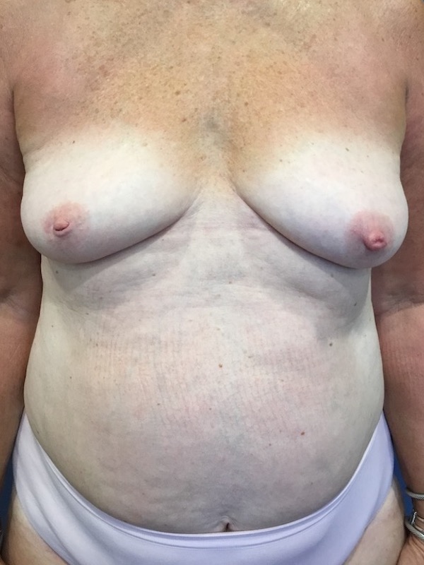  bna image b