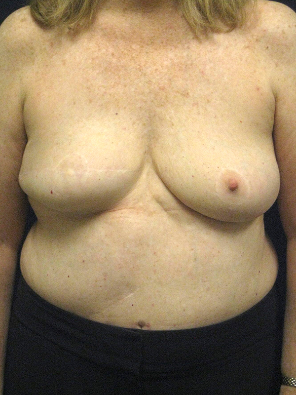 bna image