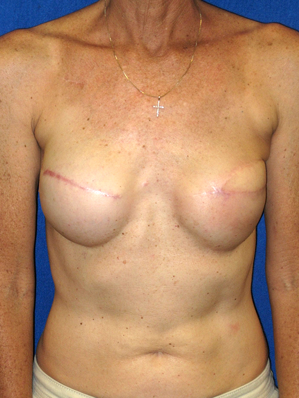 bna image
