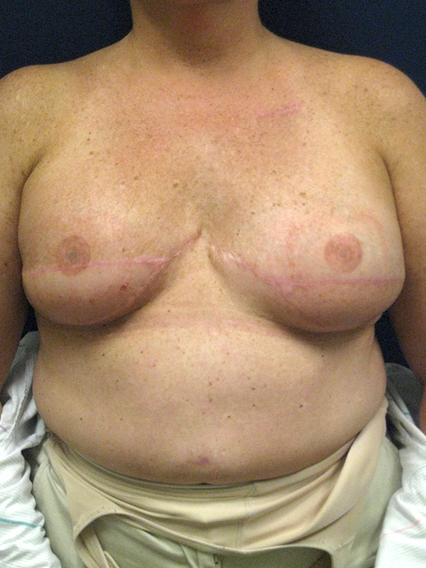 bna image