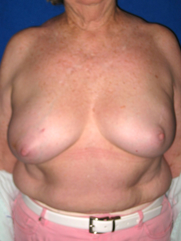  bna image b