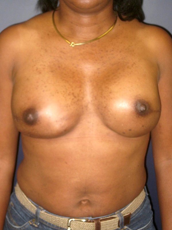 bna image