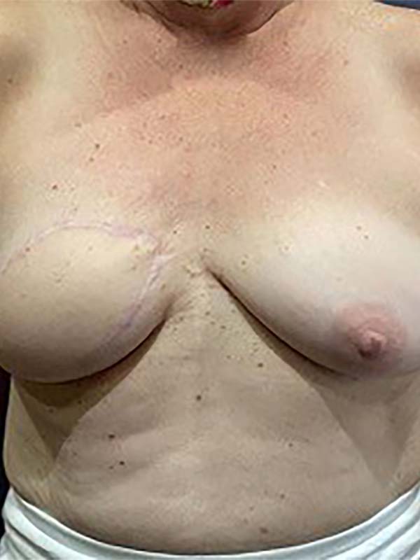 bna image