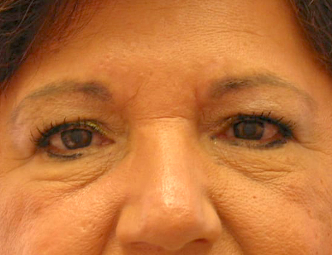  bna image b