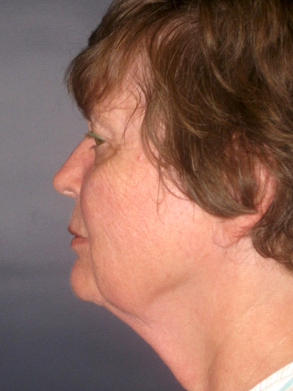  bna image b
