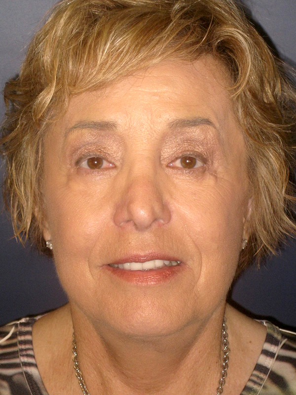 bna image
