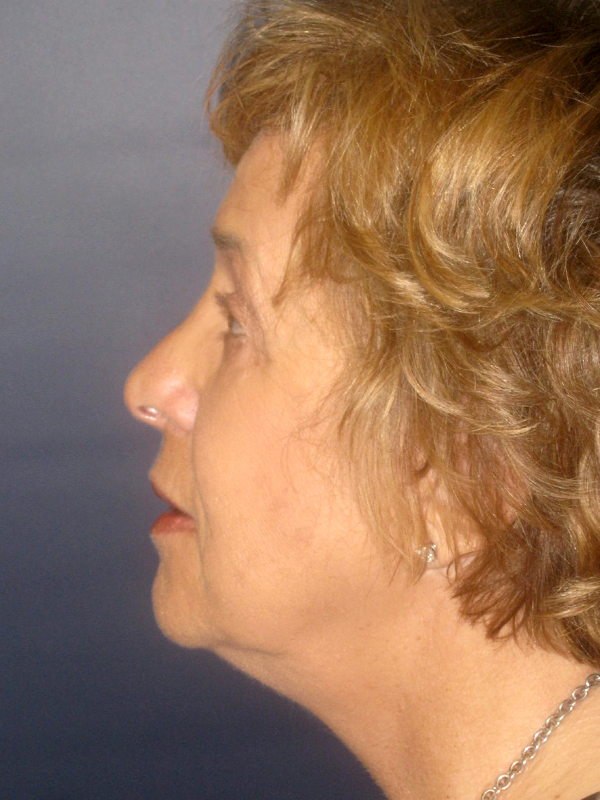 bna image
