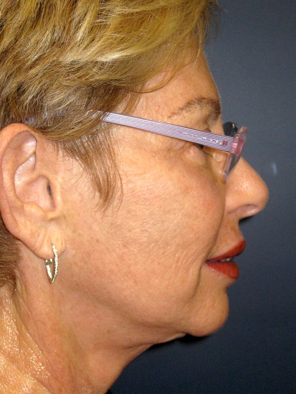 bna image