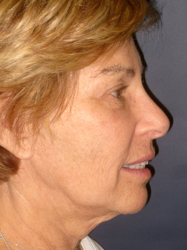  bna image b