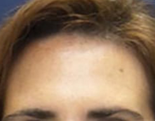 bna image