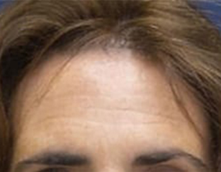  bna image b