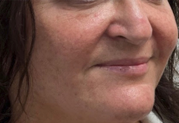  bna image b