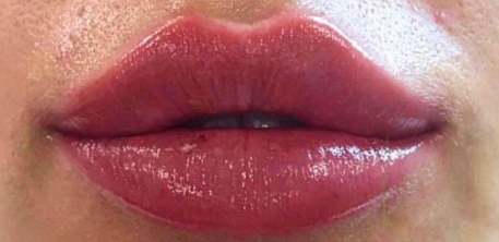 bna image