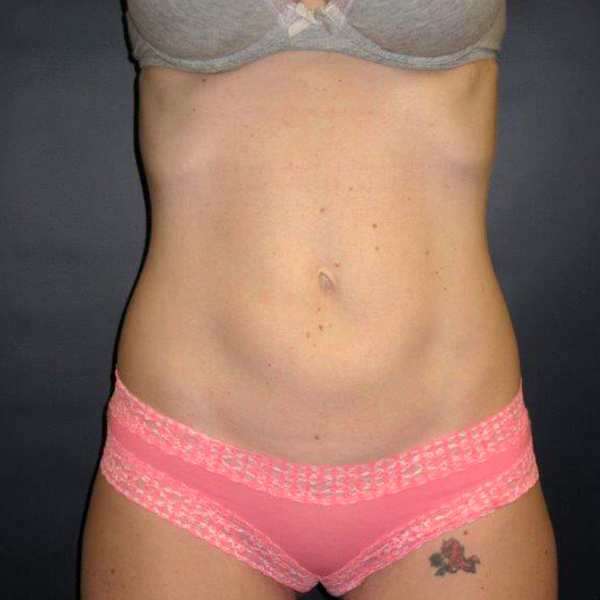 bna image