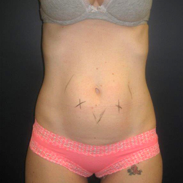  bna image b