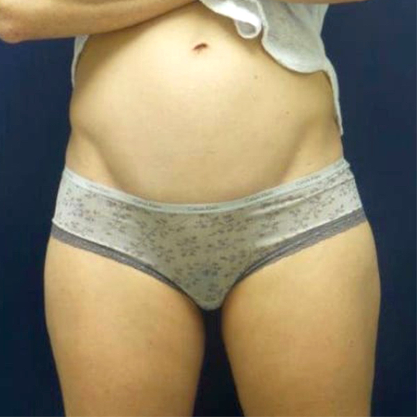 bna image