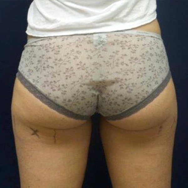 bna image