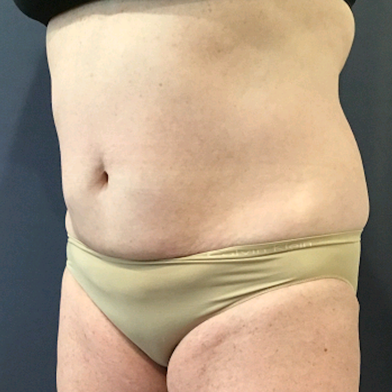 bna image