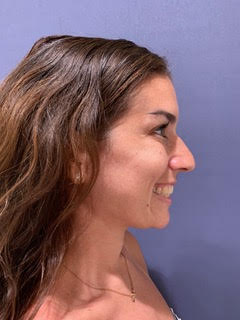 bna image