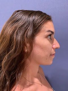 bna image