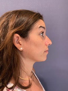 bna image b
