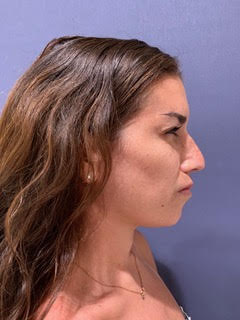 bna image