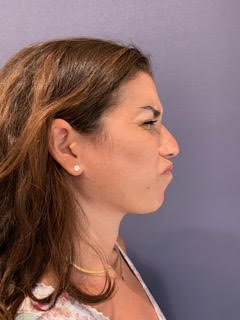 bna image b