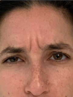  bna image b